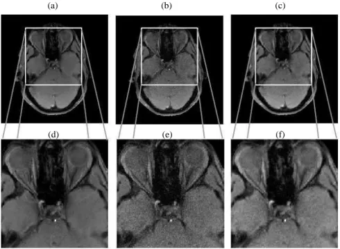 Fig. 2. (a): Magnitude of the reference image: range in [0,91496]. (b)-(c): Magnitude of the restored images by SENSE and the proposed Stein-LET approach, respectively