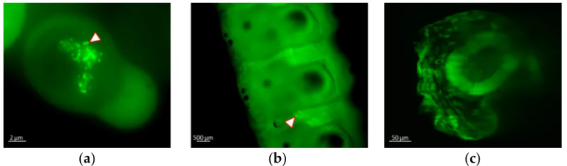 Figure 3. Visualization of recombinant virus infection by fluorescence microscopy using a Zeiss  Axiovert Observer Z1 in (a) S