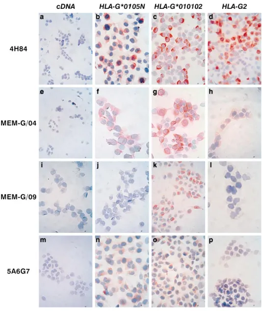 FIG. 5. Immunocytostaining of M8 trans- trans-fectants with anti-HLA-G antibodies 4H84 (a–d), MEM-G/04 (e–h), MEM-G/09 (i–l), and 5A6G7 (m–p)