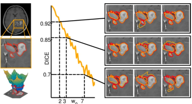 Fig. 4: (Left) Segmentation of brain tumor active rim from T1 MR image with Gadolinium contrast agent; (Right) Relationship between the parameter ω 0 and the inter-sample DICE score
