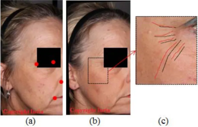 Fig. 1. A simple registration scheme based on land marks does not register wrinkles. (a) Baseline with land marks shown as red dots