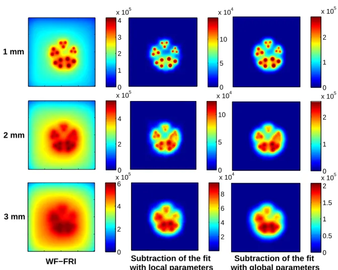 Figure 8. Images of the resolution target at three different depths obtained with WF-FRI (left column), the local parametes fitting method (central column) and the global parameters fitting method (right column).