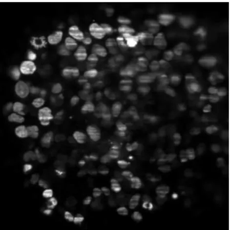 Figure 1: Example of a SPIM image (Multicellular tumor spheroid).