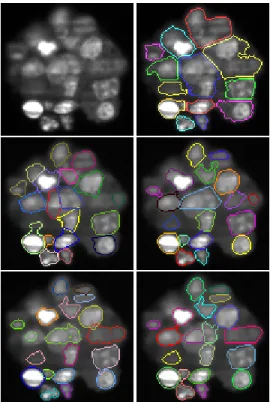Table 1. Results obtained with the ImageJ Particle Analyzer for two different parameter values (PA1 and PA2), with one realization of random seeds (W100 :mean value on 100 samples and B100: best result over 100 samples) and with the proposed Segmentation  