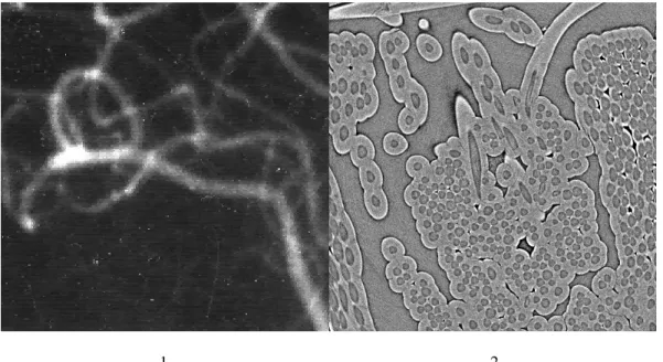 Figure a: Images showing tubular or cylindrical objects; 1) vascular networks (angiography); 