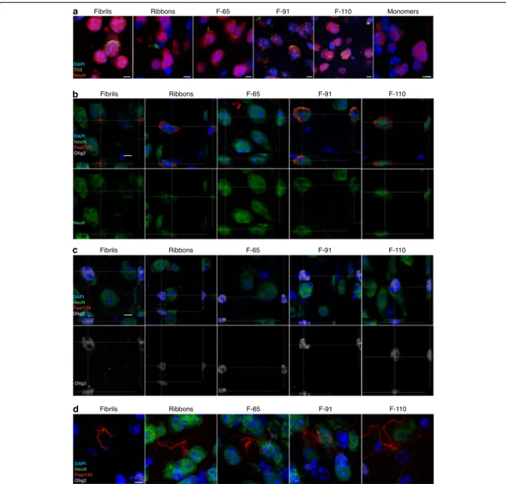 Fig. 6 Inclusions are Thioflavin S positive and predominantly localized within neurons