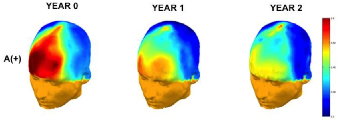 FIG 2- Longitudinalθ/α power ratio changes of A+ participants in EEG at-rest 