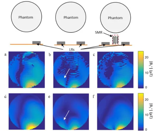Fig. 6. Field maps of the central axial slice of the right LR: isolated (a,d), without (b, e), and with (c, f) the SMR