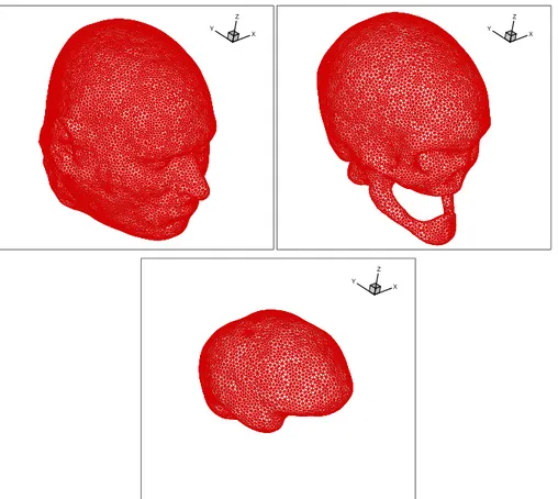 Figure 11: Exposure of head tissues to a loalized soure radiation: surfae meshes of the
