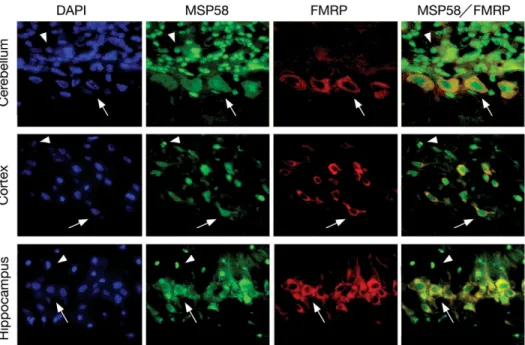 Figure 7. MSP58 is present in the nucleus and in the cytoplasm of neurons. (A) Electron micrograph of the soma of labelled Purkinje and granular cells