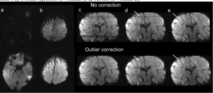 Figure 2: Automated resampling of corrupted slices 