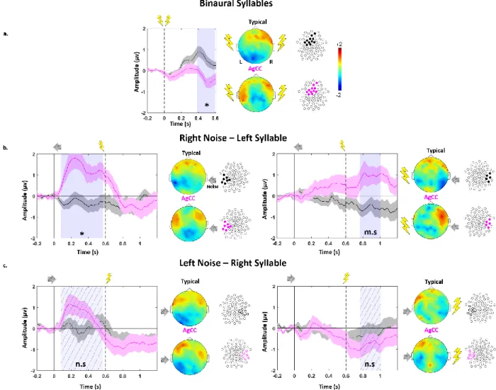 Figure 1: Topographical differences between typical and AgCC infants:  