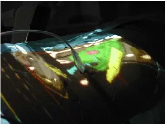 Fig. 2. Augmented reality applied to percutaneous nephrolithotomy, Tenon hospital. October 2003.