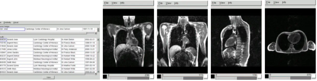 Figure 3. from left to right: application user interface, source image and matching images with highest to lowest score.