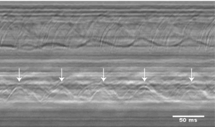 Fig. 1. A line is drawn parallel to the surface of the ciliate cells where the cilia are moving