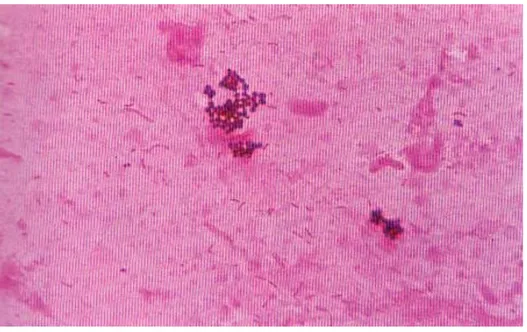 Figure    4 : Pseudomonas aeruginosa. Coloration de Gram (D’après Hart T. et Shears P., 1997).