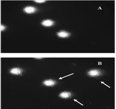 Figure 11 : Images typiques de microscopie à fluorescence (comètes) de LBP humaines à  gauche non exposés (A) ou exposés à la colistine à 1 100 ng/ml (B)