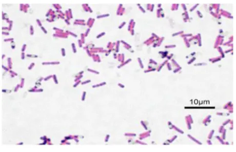 Figure 01 : Bactérie Gram négative   Figure 02 : Bactérie Gram postive 