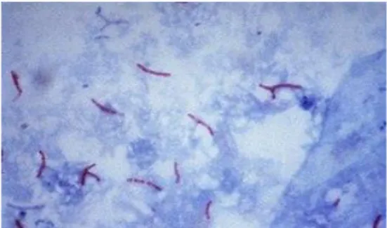 Figure 03 : mycobactérium tuberculosis après coloration de ziehl-neelsen. 