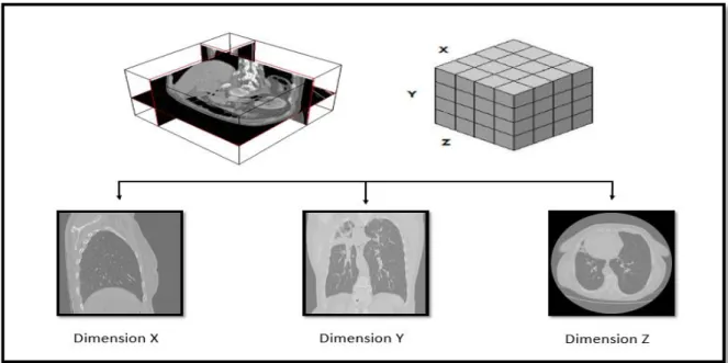 Figure 4 - Image médicale - représentation 3d 