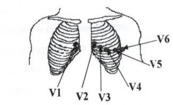 Figure 1.7 : Les dérivations précordiales. 