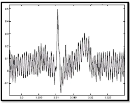 Figure 1.12 : Interférence secteur 50 Hz. 