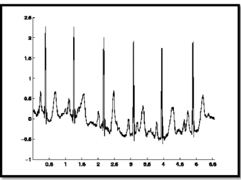 Figure 1.13 : Bruit dû aux mouvements des électrodes. 