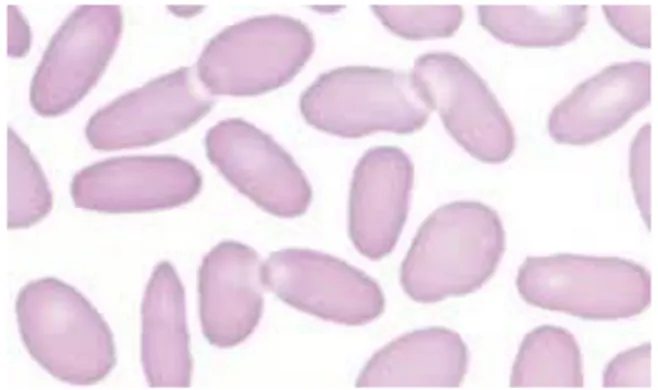 Fig 07 : Elliptocyte ou ovalocyte ( Hoffman et al ., 2012 ) 