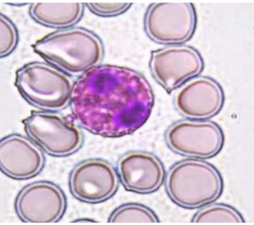 Fig 19 : Eosinophilies (microscopie optique) (Kohler, 2011)  