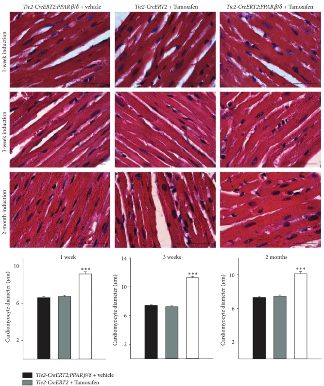 Figure 3: Enhanced cardiomyocyte diameter upon vascular-speciic PPAR � / � overexpression