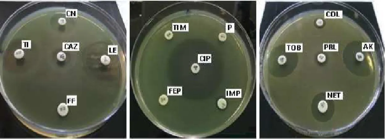 Figure 3. Sensitivity of P. aeruginosa towards antibiotics studied: Penicillin G (P), Piperacillin (PRL),  Ticarcillin (TI), Ticarcillin-clavulanate (TIM), Imipenem (IMP), Ceftazidime (CAZ), Cefepime (FEP), 