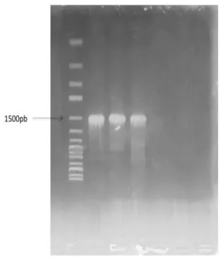 Fig. 1. Agarose gel electrophoresis of the polymerase  chain reaction (PCR) amplified 16S-rRNA gene for P1,  P2 and P3