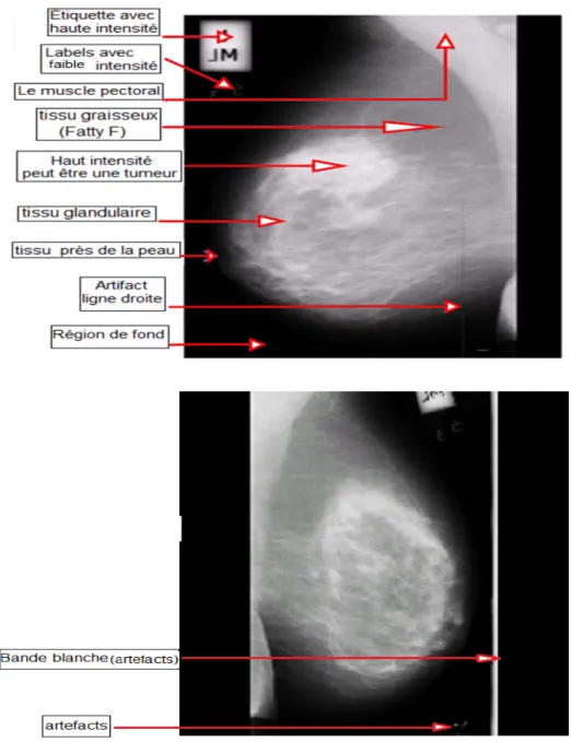 Figure 1.3     Les éléments d’une  mammographie 