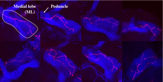 Fig. 2.5 Adult single cell confocal in vivo images. Examples of our database, exhibiting a single adult wild-type γ axon (red) and the dorsal and medial lobes of the MB (blue)