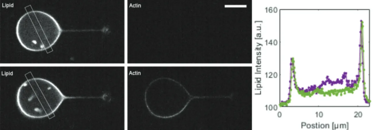 FIG. 6. Confocal images of a liposome before (top) and after (bottom) actin polymerization