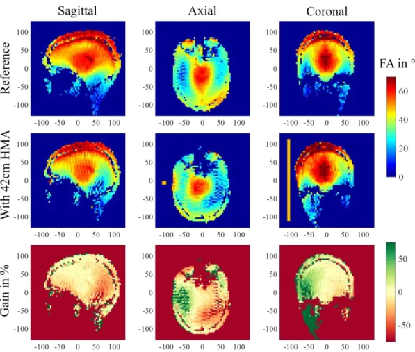 Figure 2 – Three orientation slices presenting (top row) the reference FA maps (in degrees)  obtained with the coil alone (central row) the FA maps obtained when a 42-cm-long HMA is set