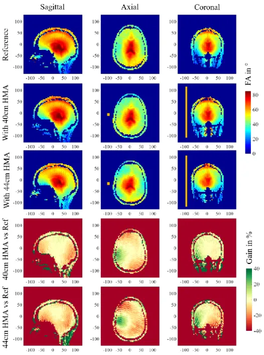 Figure 3 – Three orientation slices presenting (top row) the reference FA maps (in degrees)  obtained with the coil alone (second row) the FA maps obtained when a 40-cm-long HMA is set  and (third row) with a 44-cm-long HMA in the same location