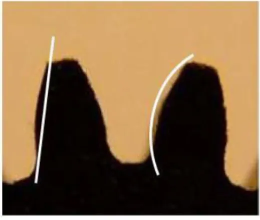 Figure 1.6 : Profil d’une dent en comparaison avec une droite et un arc de cercle  