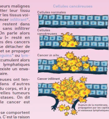 Figure 4 : Caractéristiques d’un tissu cancéreux. (Le guide comprendre le cancer du sein,  2002)