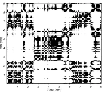 Figure 2.7 : Matrice de diagramme de récurrence de la série temporelle RR  (Noir=1et blanc=0) [61]