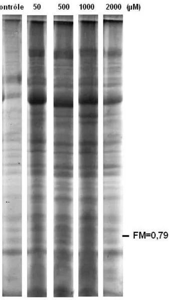 Figure 08: Electrophorèse verticale sur SDS-PAGE des extraits protéiques des feuilles d’A