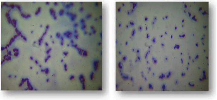 Figure 12 : observation microscopiques des souches des Lactocoques isolées après coloration de  Gram (G×100)