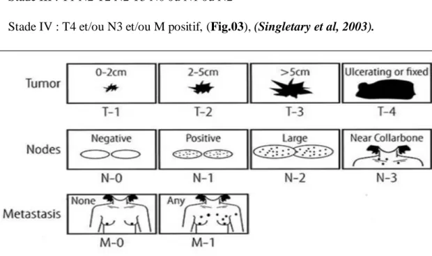 Figure 03 :  Classification TNM du cancer du sein,( Singletary et al, 2003).