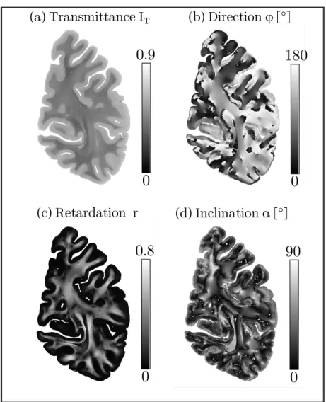 Figure 3.6: Parameter maps of a coronal section from the right hemisphere of the human brain imaged at 64 × 64 × 70µm 3 resolution: (a) normalized transmittance I N = I (ρ)/I T , (b) in-plane direction angle ϕ, (c) retardation r, and (d) out-of-plane incli