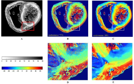 Figure 4.3: Inclination angle maps of a coronal ventricular slice: (A) Absolute inclination.