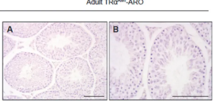Fig 3. Histological sections of adult TR α AMI -ARO testes at low (a) and high (b) magnification.