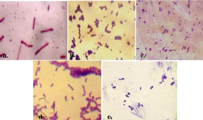 Figure 27 : Observation microscopique des souches de l’échantillon 1 après la  coloration de Gram (G x100), (a) Lactobacillus, (b) Streptococcus, (c) Pediococcus, (d) 