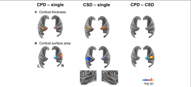FIGURE 3 | Significant variations of Cortical Thickness (CT) and Cortical Surface Area (CSA) in the “CPD–single HG”, “CSD–single HG” and