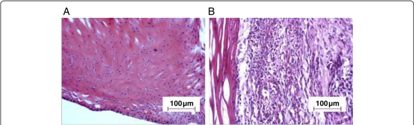 Figure 2 Histological characterization of the RA model in DA rats. Tissue slides from joints of non-treated rats (A) and joints from Mtb- Mtb-treated rats (B) were analyzed at 20 days post-injection using Hematoxylin and Eosin stained sections from ankle j