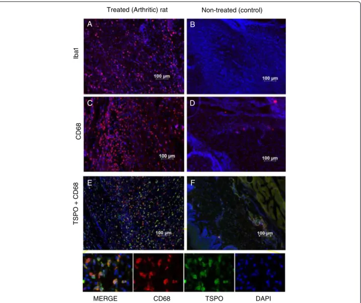 Figure 3 TSPO expression in hind paws of RA rats is associated with activated macrophages